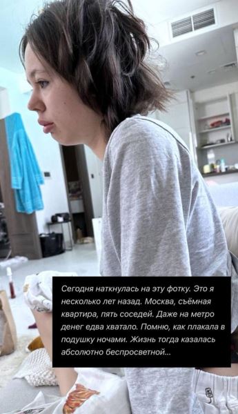 Инстасамка показала, как выглядела до популярности